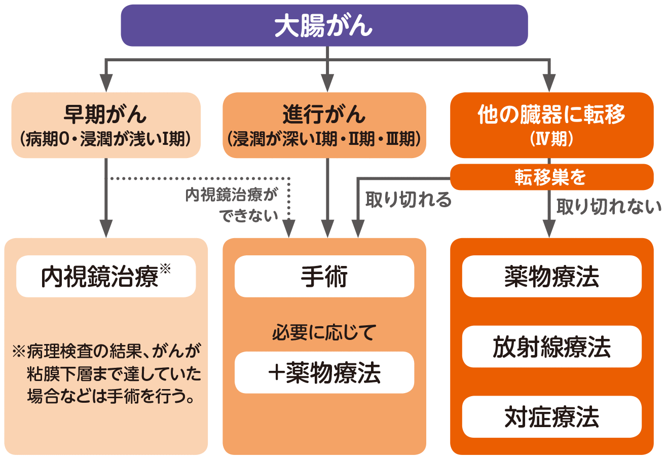 大腸がんの治療法