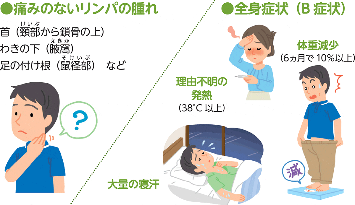 ホジキンリンパ腫の主な症状の図。主な症状は痛みのないリンパの腫れと全身症状(B症状)に分類されます。全身症状には6ヶ月で10%以上の体重減少、38度以上の理由不明の発熱、大量の発汗があります。