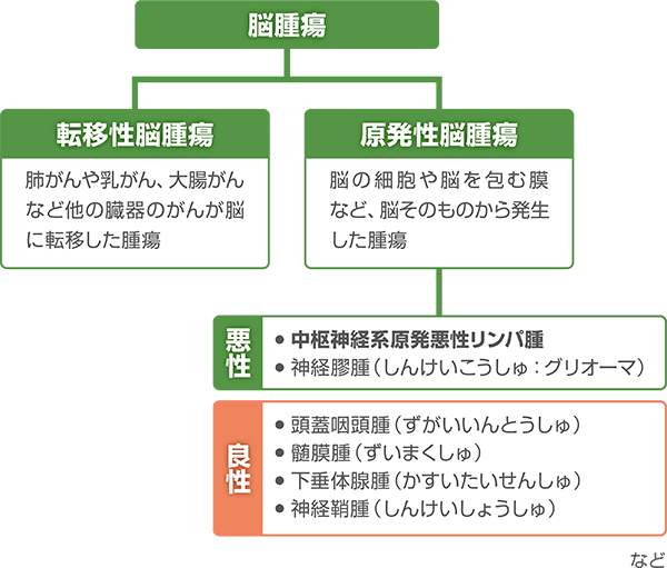 脳腫瘍の分類