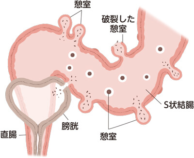 消化管